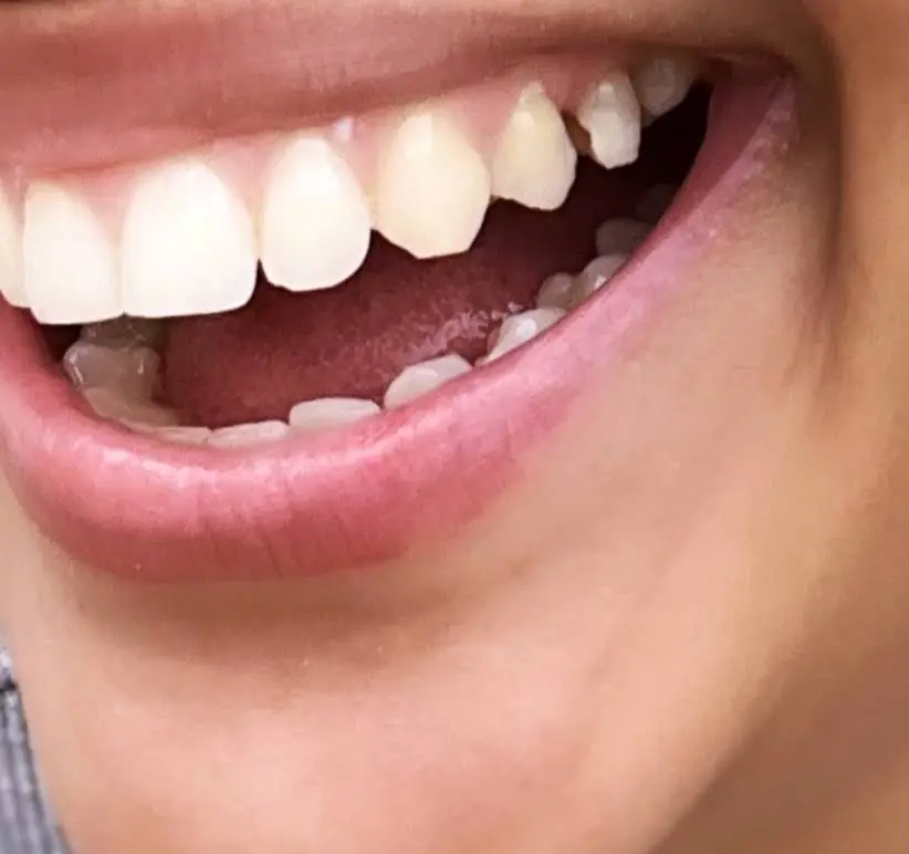 Premier Dental of Edison