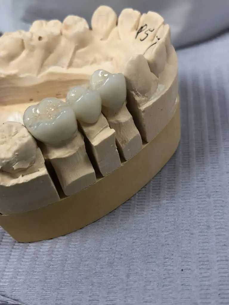 Sculpted Smiles