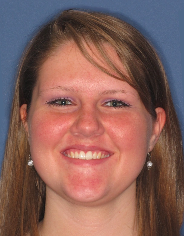 Glamorous Smile Dental Spa