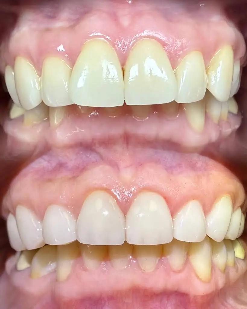 Smile Design NJ