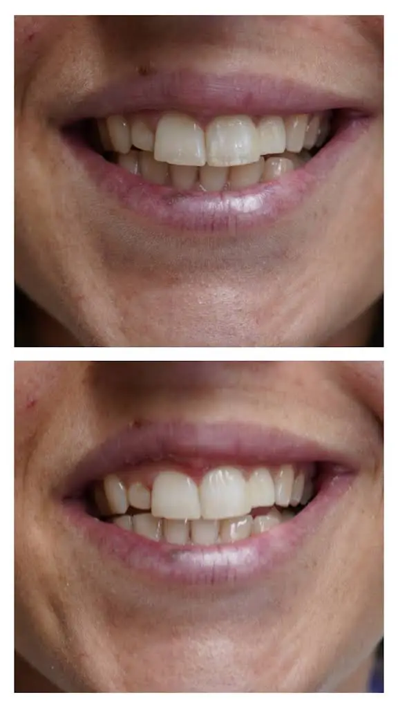 Kenilworth Dental Care