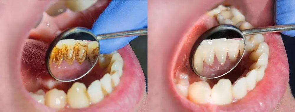 Dental Cosmetic Center of Edison