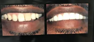 Sonet Family Dental