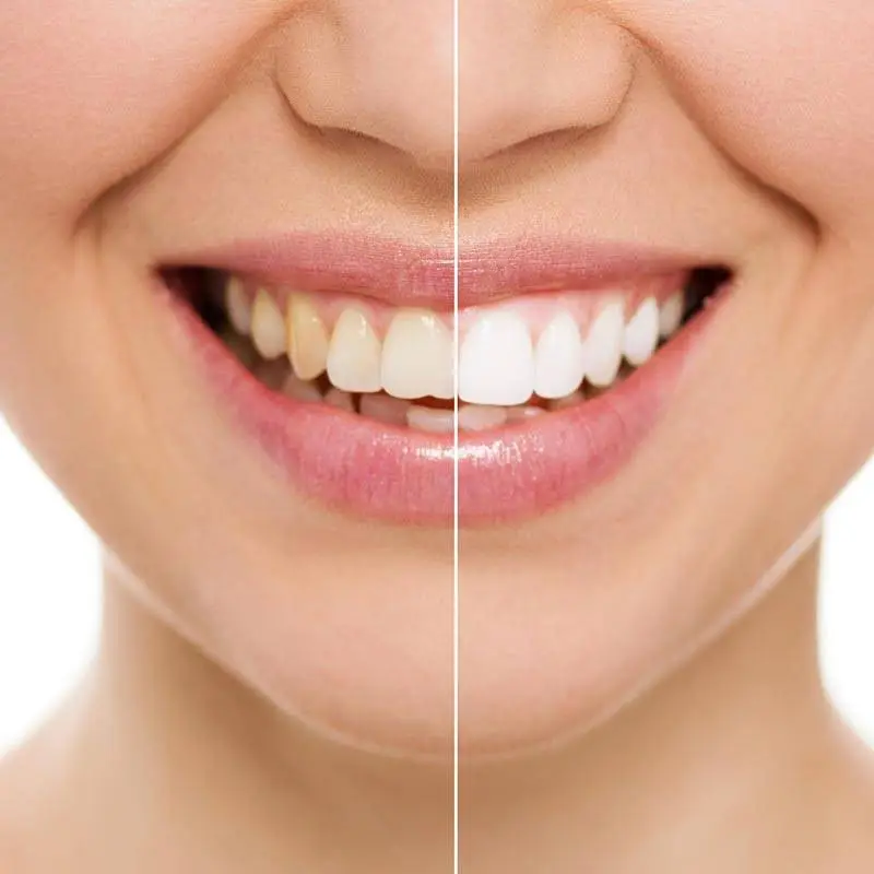 Advanced Smiles, P.C.
