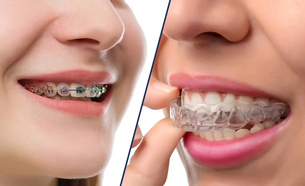 Monroe Orthodontics LLC