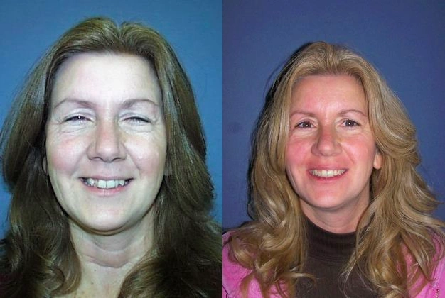 Kellyn Hodges Orthodontics
