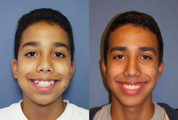 Kellyn Hodges Orthodontics