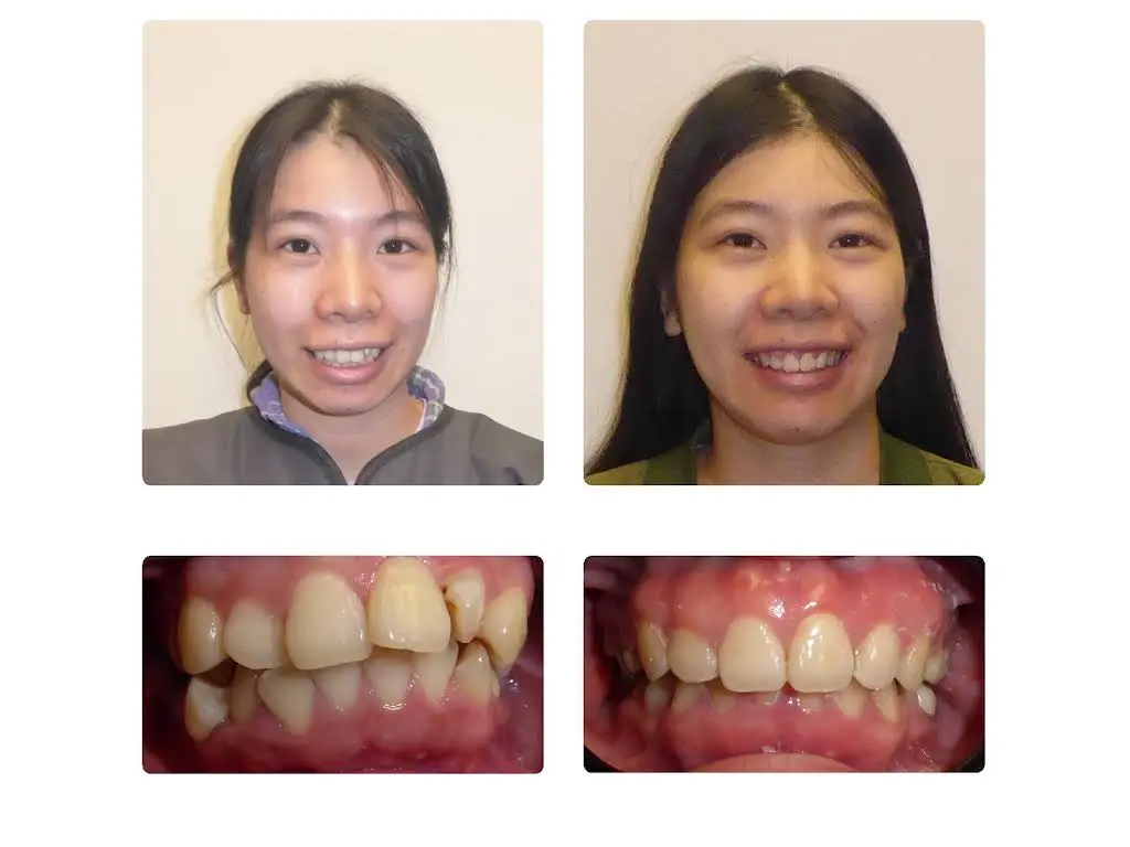Harold Slutsky D.M.D., P.C. / Philadelphia Braces