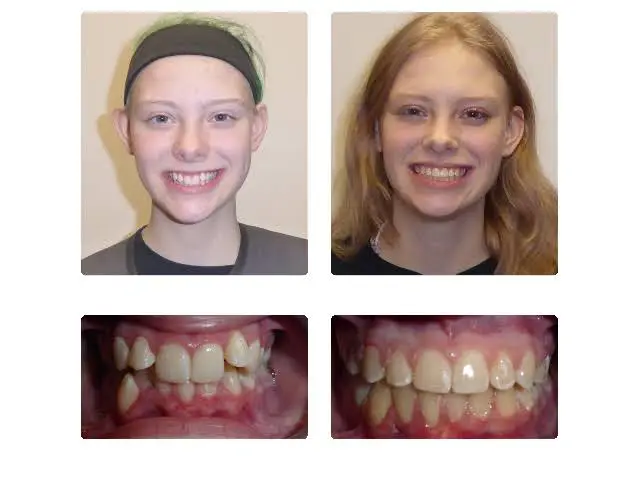 Harold Slutsky D.M.D., P.C. / Philadelphia Braces