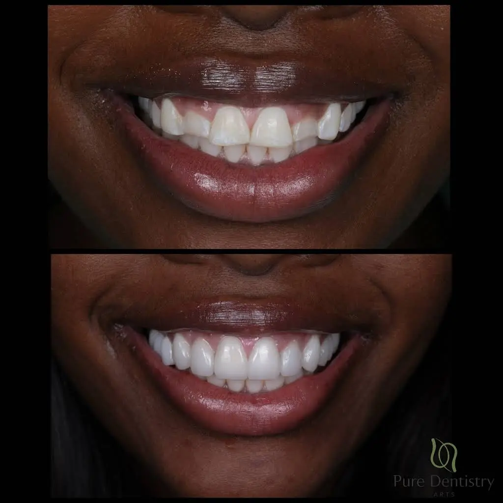 Pure Dentistry Arts