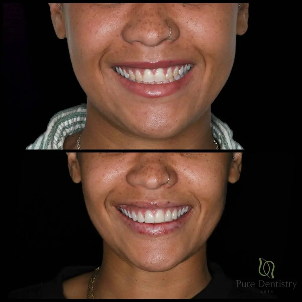 Pure Dentistry Arts