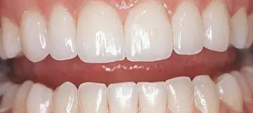 Preferred Dental Associates