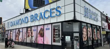 Diamond Braces