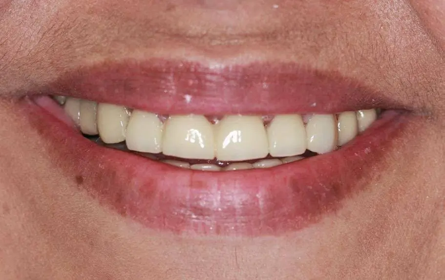 Bright Smile Design