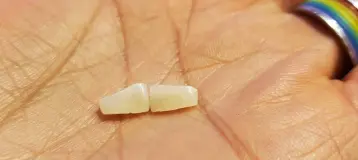 MG Dental Associates