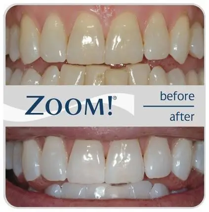 READY DENTAL EDISON