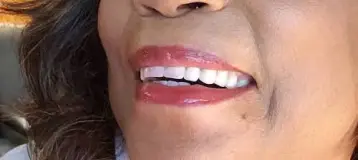 Edison Prosthodontics