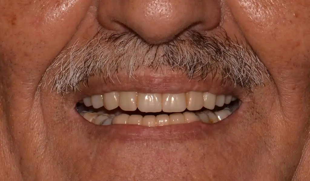 Edison Prosthodontics