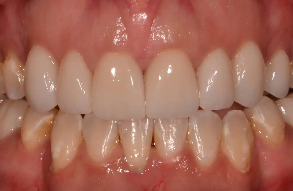Edison Prosthodontics