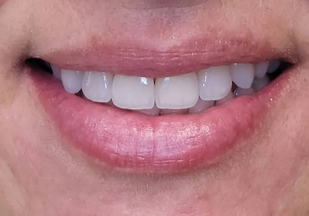Edison Prosthodontics
