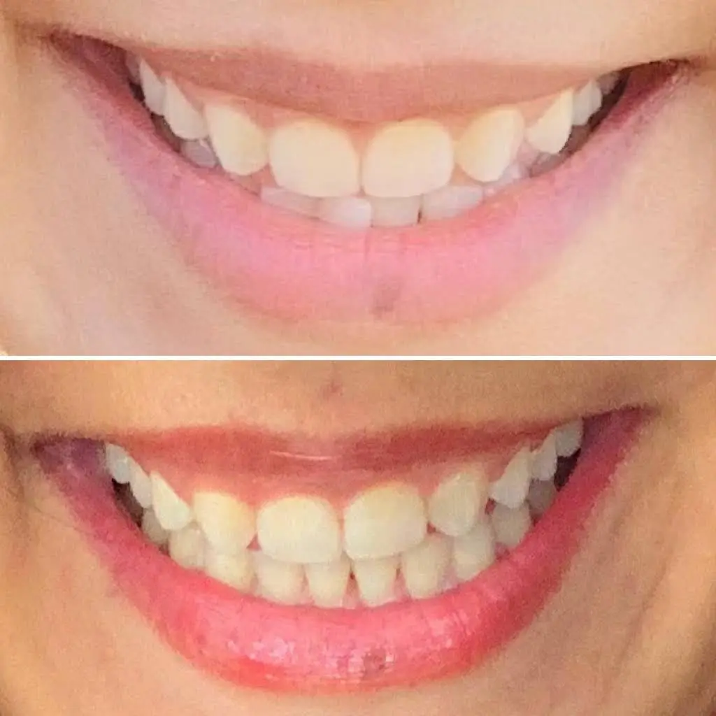 Clearsmile