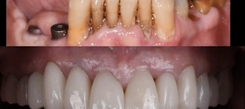 Bender & Todaro Family Dental