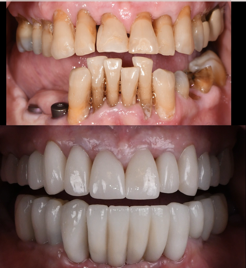 Bender & Todaro Family Dental - Professional dental clinic exterior with modern facilities