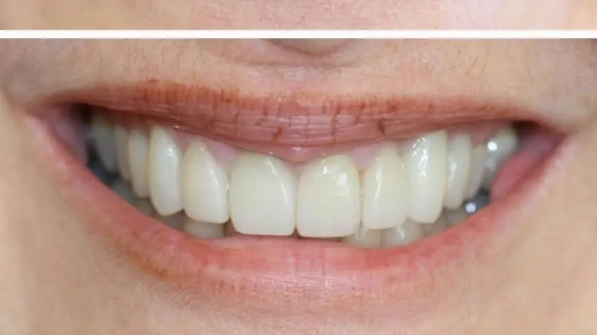 Union Hill Dental