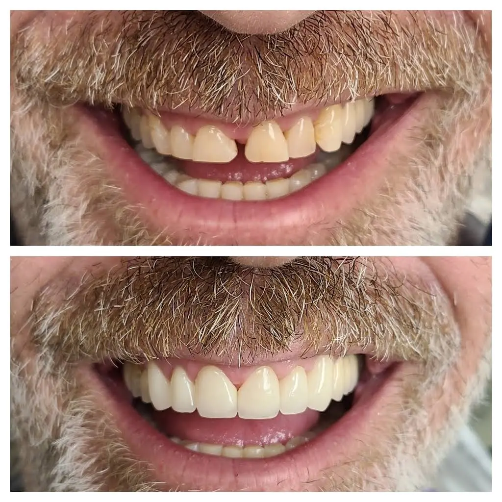 Union Hill Dental
