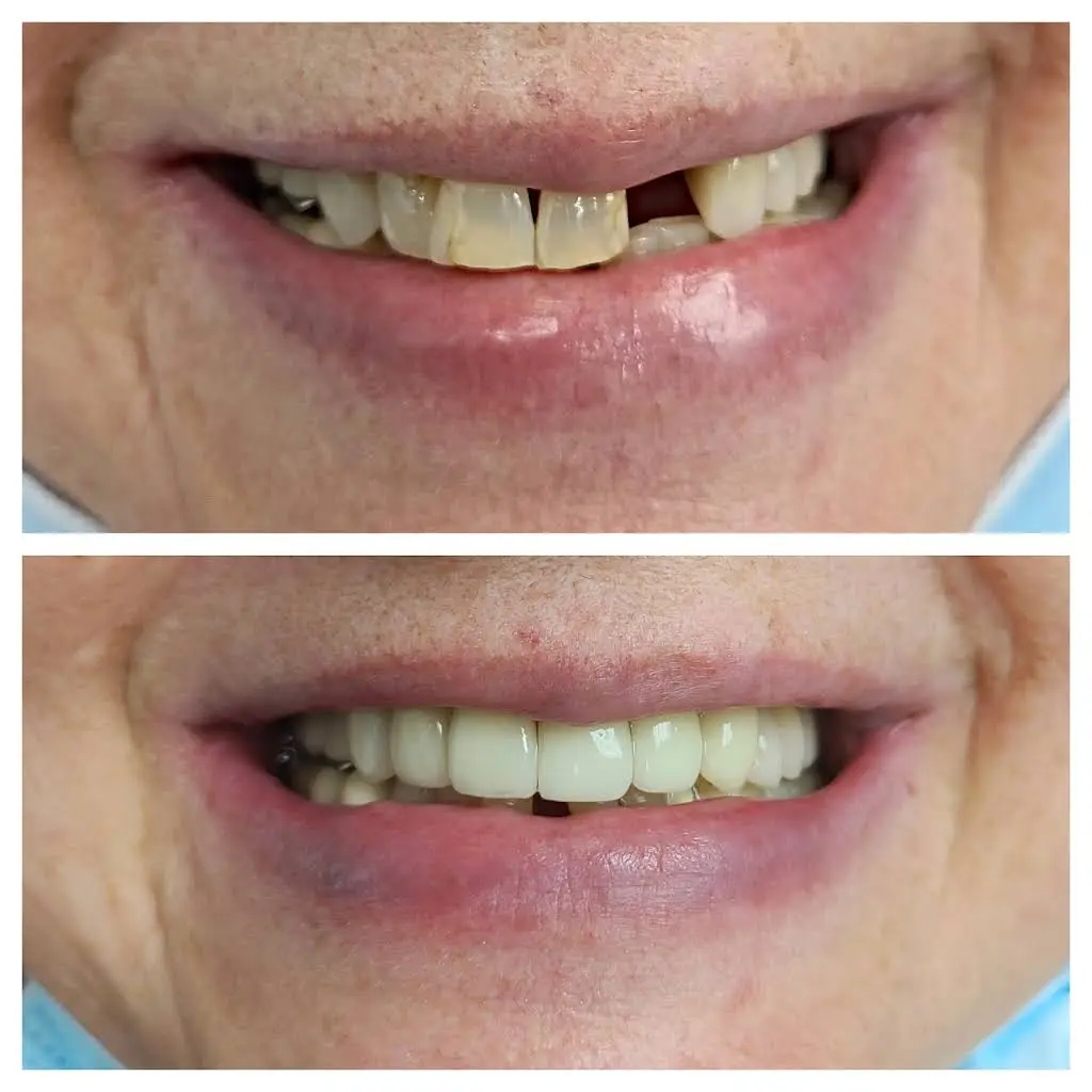 Union Hill Dental