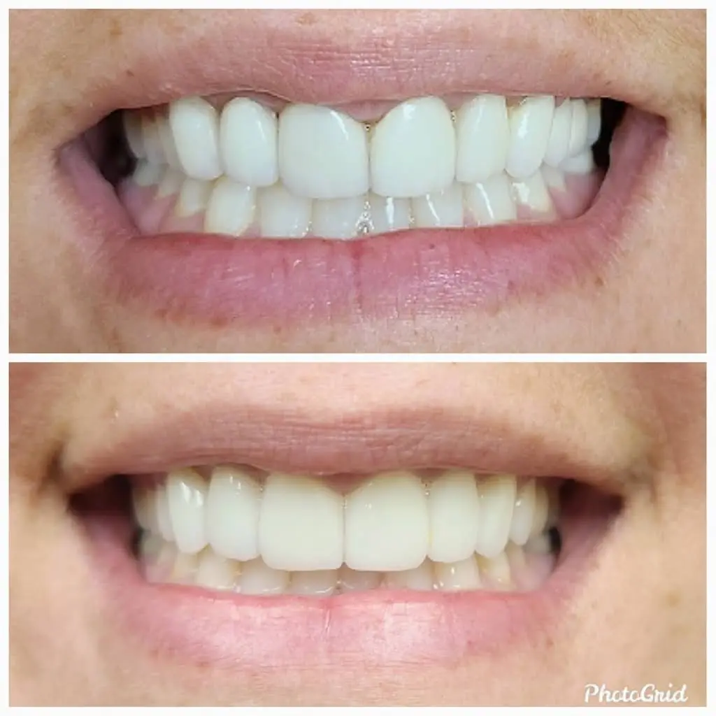 Union Hill Dental
