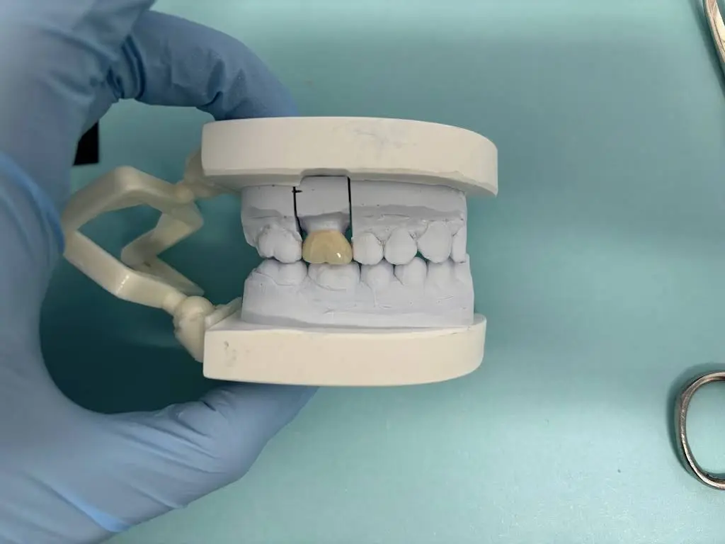 BrightBite Dental Spa