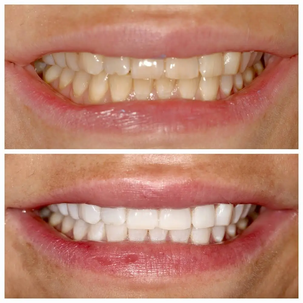 Bright Smile Dental of Brooklyn