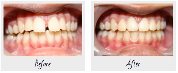 Smile Plus Dental