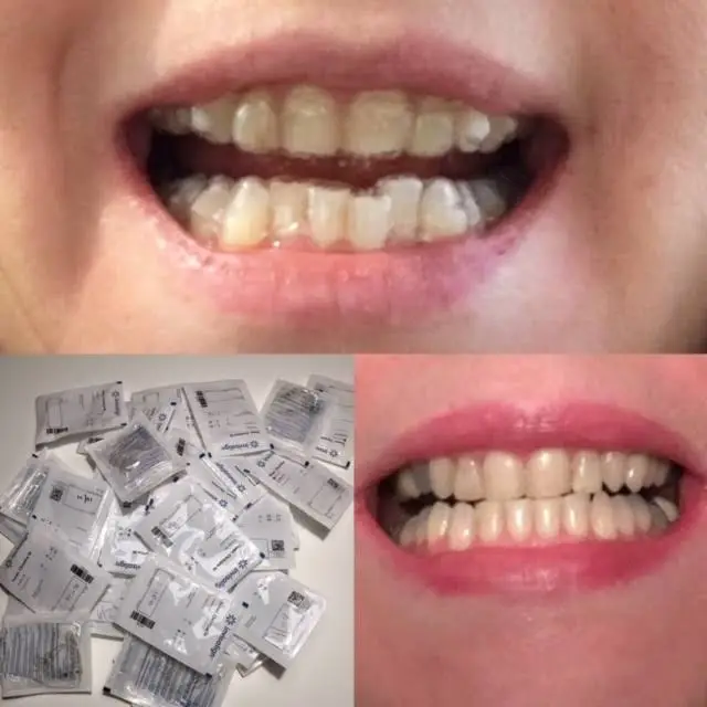 Roselle Park Dental & Implants