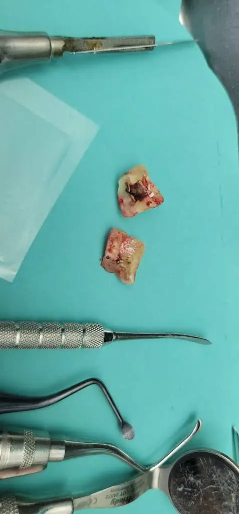 Roselle Park Dental & Implants