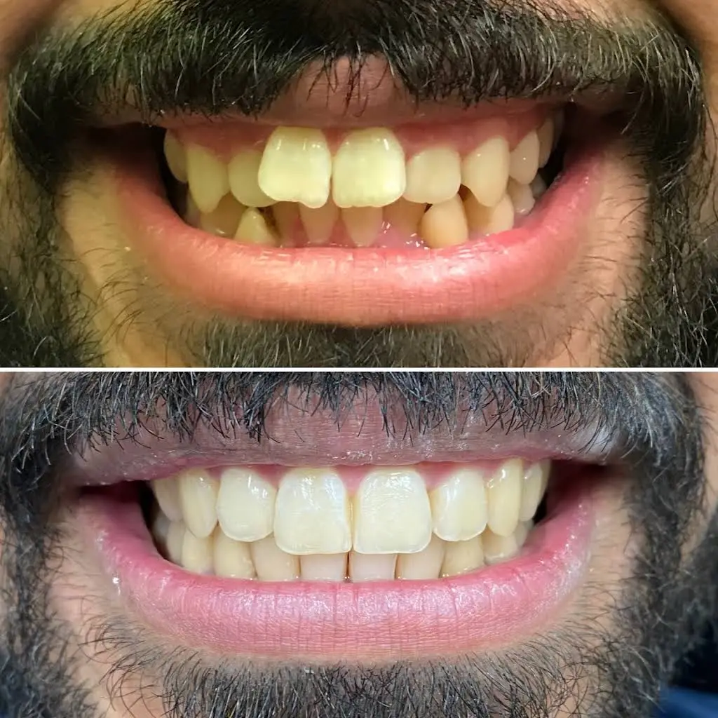 Picture Perfect Smile