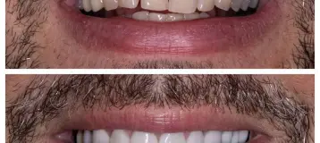 b Dental Spa at Totowa