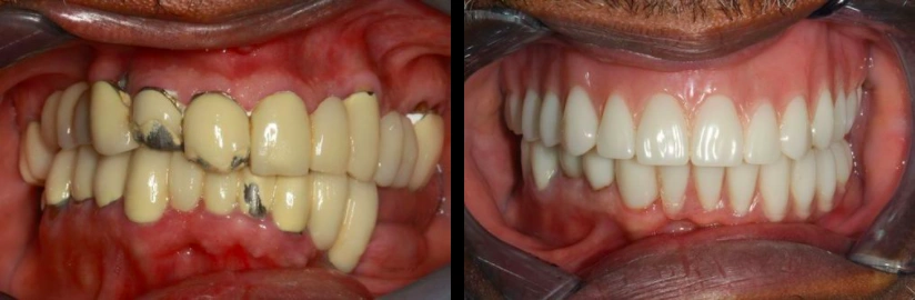 Anthony Ramirez, DDS, MAGD