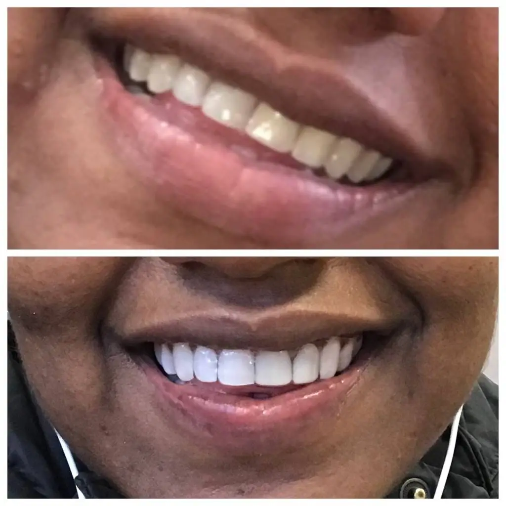 Brooklyn Heights Dental