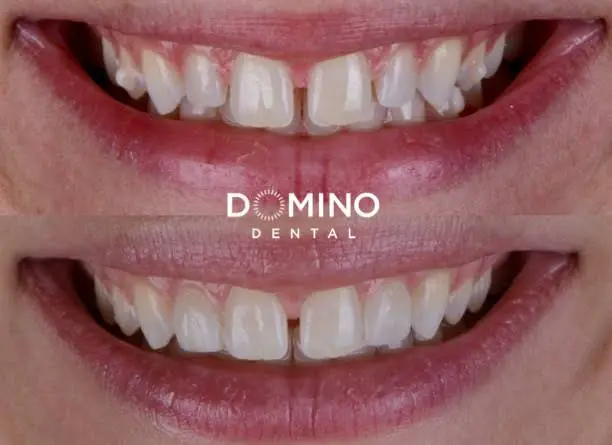 Domino Dental - Dr. Lilya Horowitz