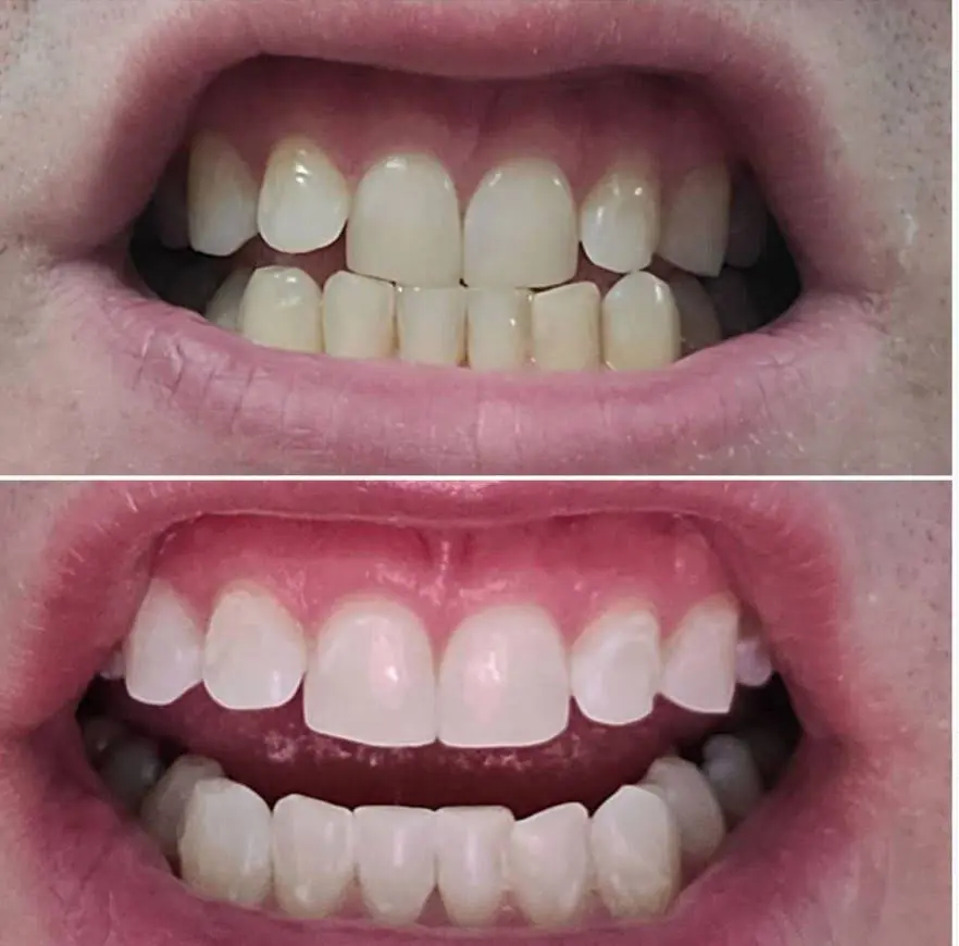 Fords Family Dental Care