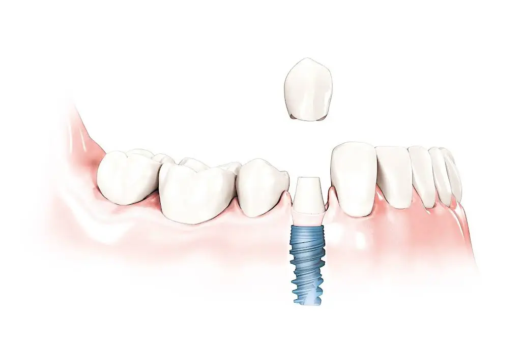 Sayreville Dental