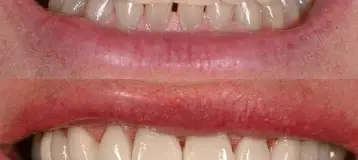 Colonia Dental Associates
