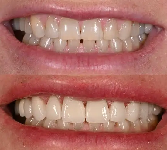 Colonia Dental Associates - Professional dental clinic exterior with modern facilities