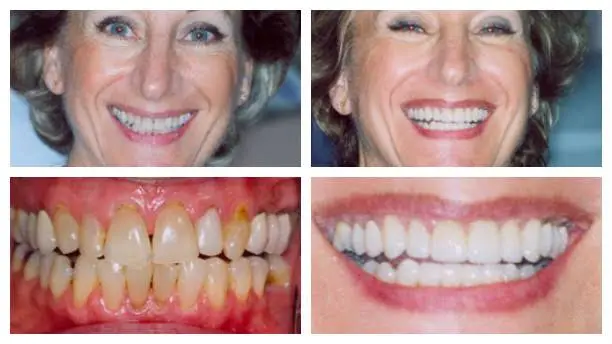 Aesthetic Dental Care of New Jersey
