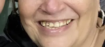 VSN Dental PC