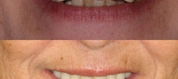 Central NJ Prosthodontics