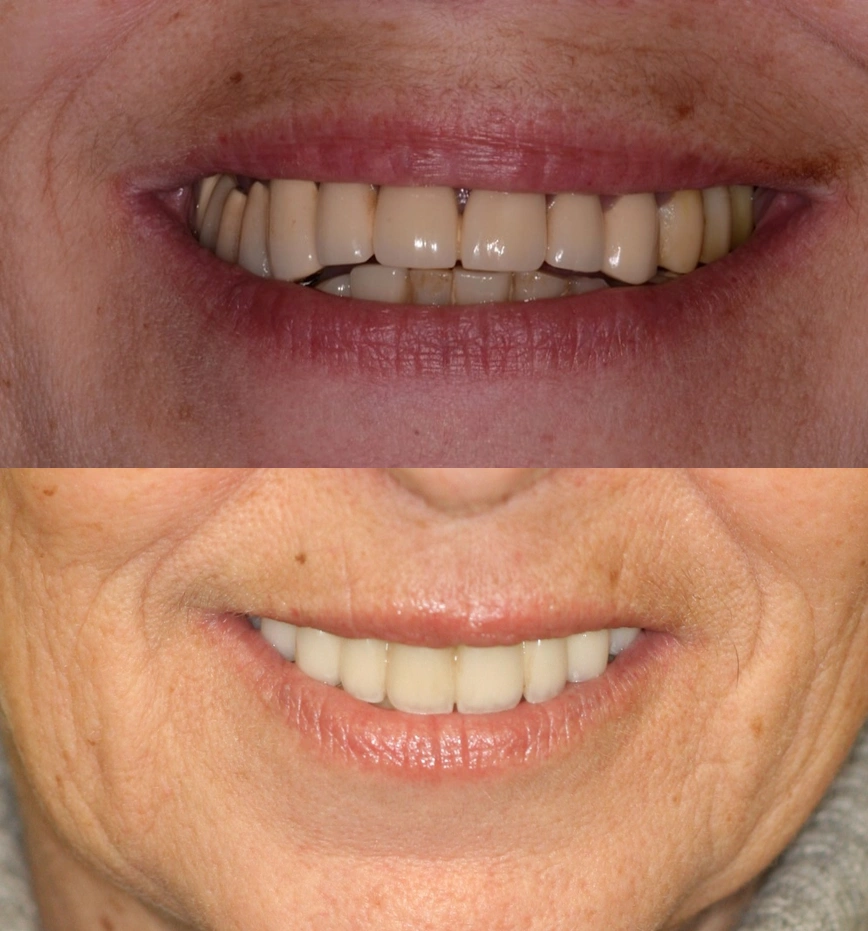 Central NJ Prosthodontics - Professional dental clinic exterior with modern facilities