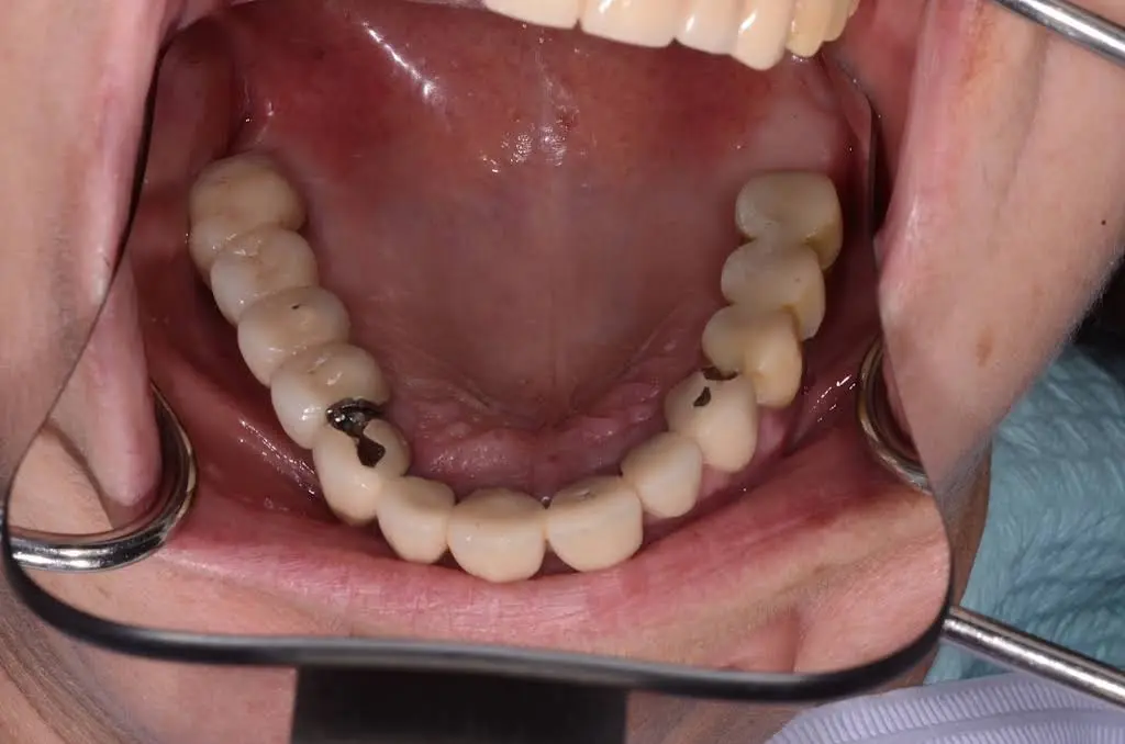 Central NJ Prosthodontics